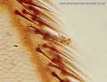 1013CR36-19_Cranefly_Wing_Edge_with_Parasite
