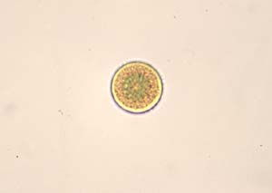 1013CR59-1_Round)Diatom
