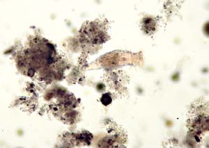 1013CR59-7_Rotifer