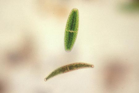 1023CR21-25_Netrium_&_Closterium