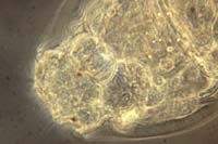 1023CR18-11_Rotifer_Detail