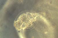 1023CR18-9_Rotifer_Complete