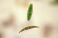 1023CR21-25_Netrium_&_Closterium