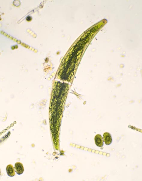 C_Closterium 2_0091